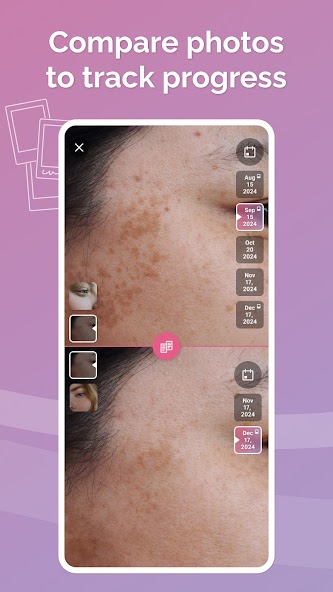 Skincare Routine: FeelinMySkin screenshot 18